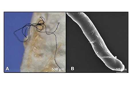 Frequency of Microplastics in Mesopelagic Fishes from the Northwest Atlantic