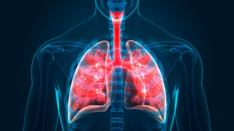 Researchers find microplastics deep in the lungs of living human for the first time.